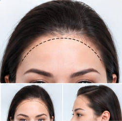 Rounded Hairline