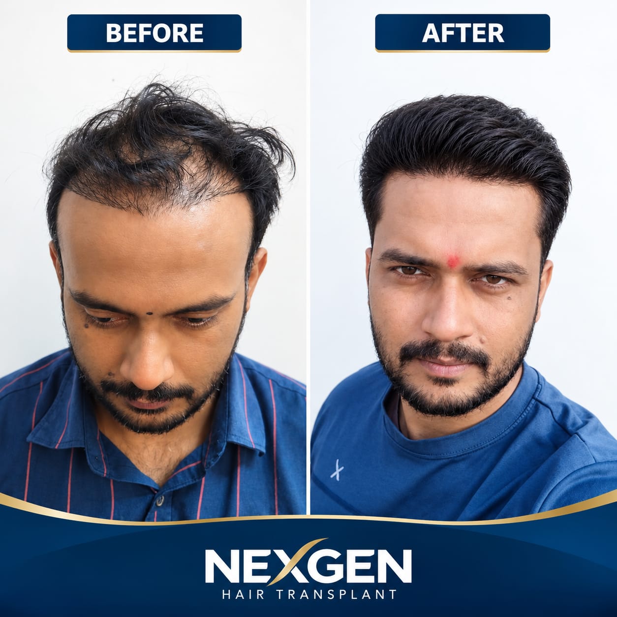 Corrective & Revision Surgery